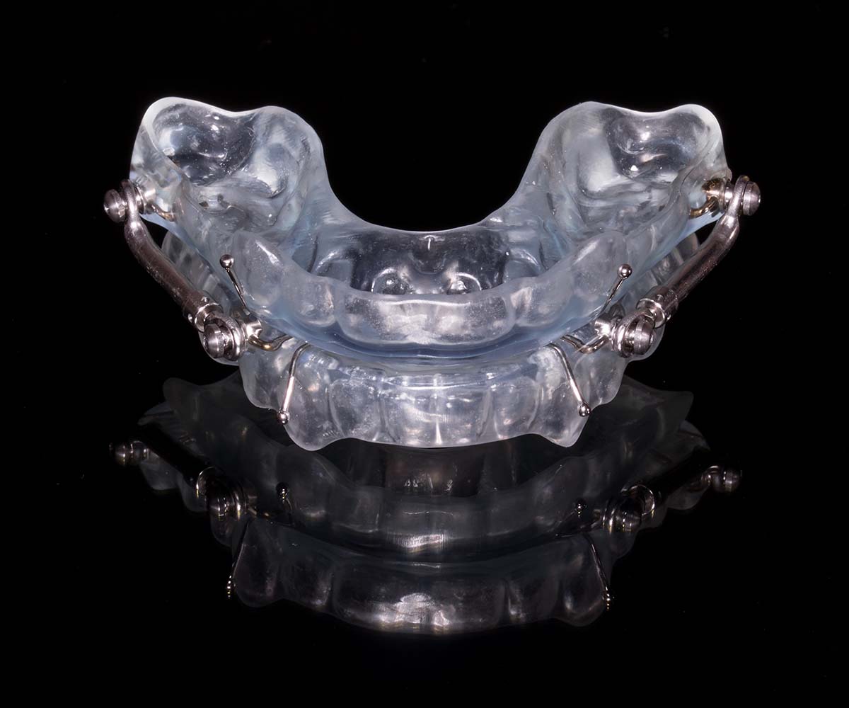 Protusore Mandibolare