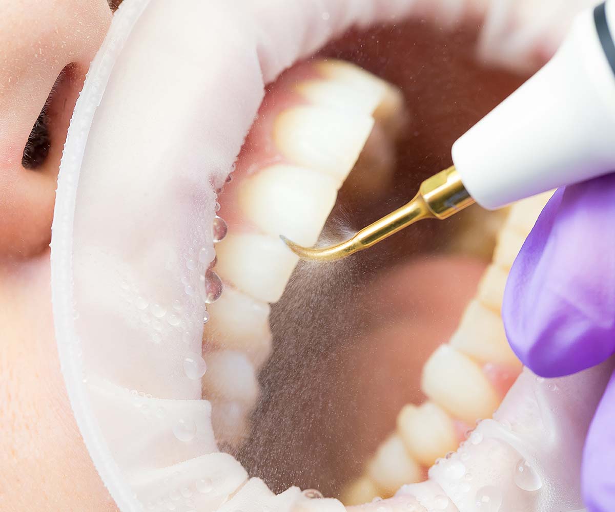 Igiene Orale Studio Smile