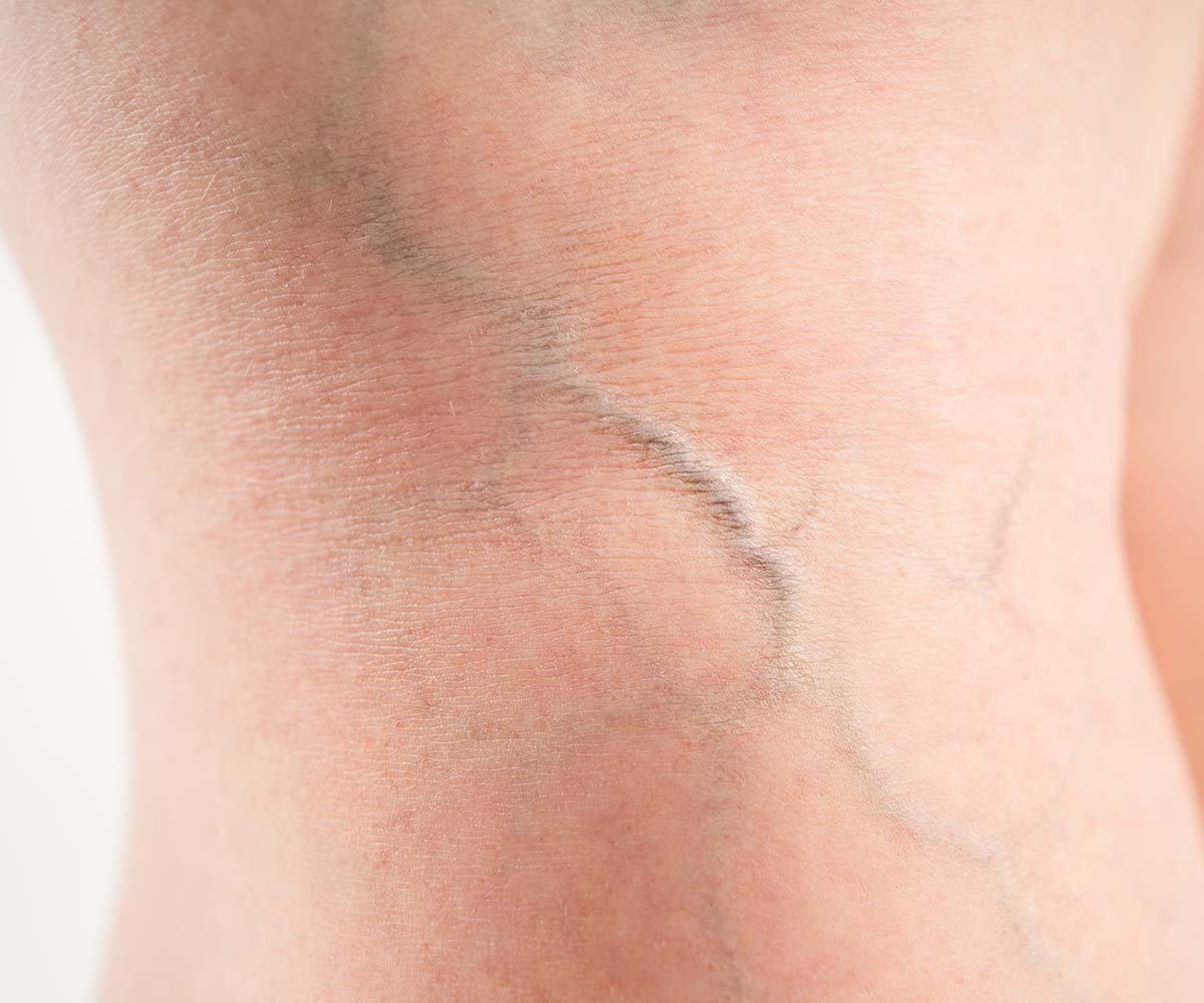 Studio delle vene Studio Smile